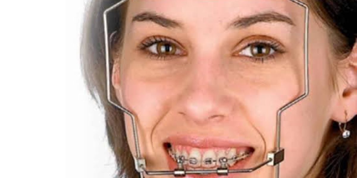 dental-head-gear-v0-kub2xoqbgedc1